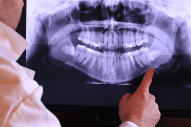 Best Emergency Treatment for Jaw Pain or Injury in Montgomery, PA