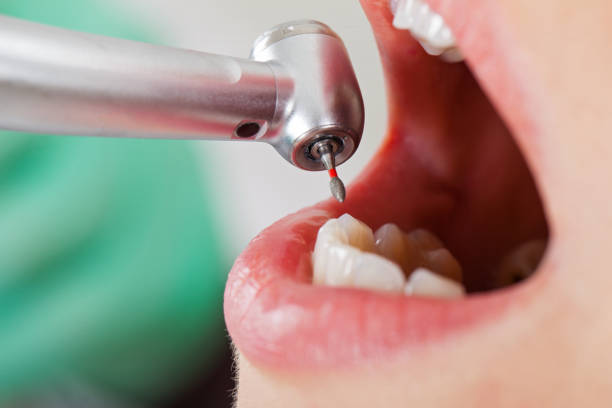 Best Dental Abscess Treatment in Montgomery, PA